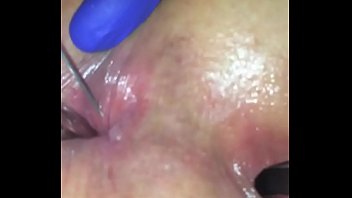 1058+ Anal injection Video